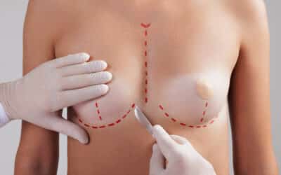 Understanding the Differences Between Breast Augmentation and Breast Lift