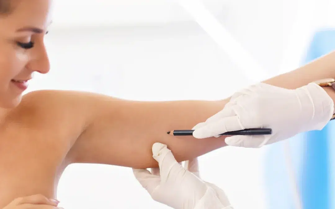 arm examination doctor patient prep